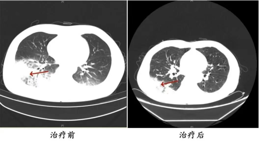 洗 专家提醒吹前必查→尊龙凯时网站空调久未清(图4)